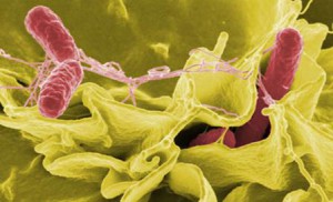 An example of Salmonella invading cultured human cells. (Rocky Mountain Laboratories, NIAID, NIH)