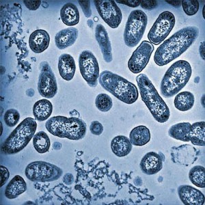 A photomicrograph of Salmonella bacteria. (Pacific Northwest National Laboratory)